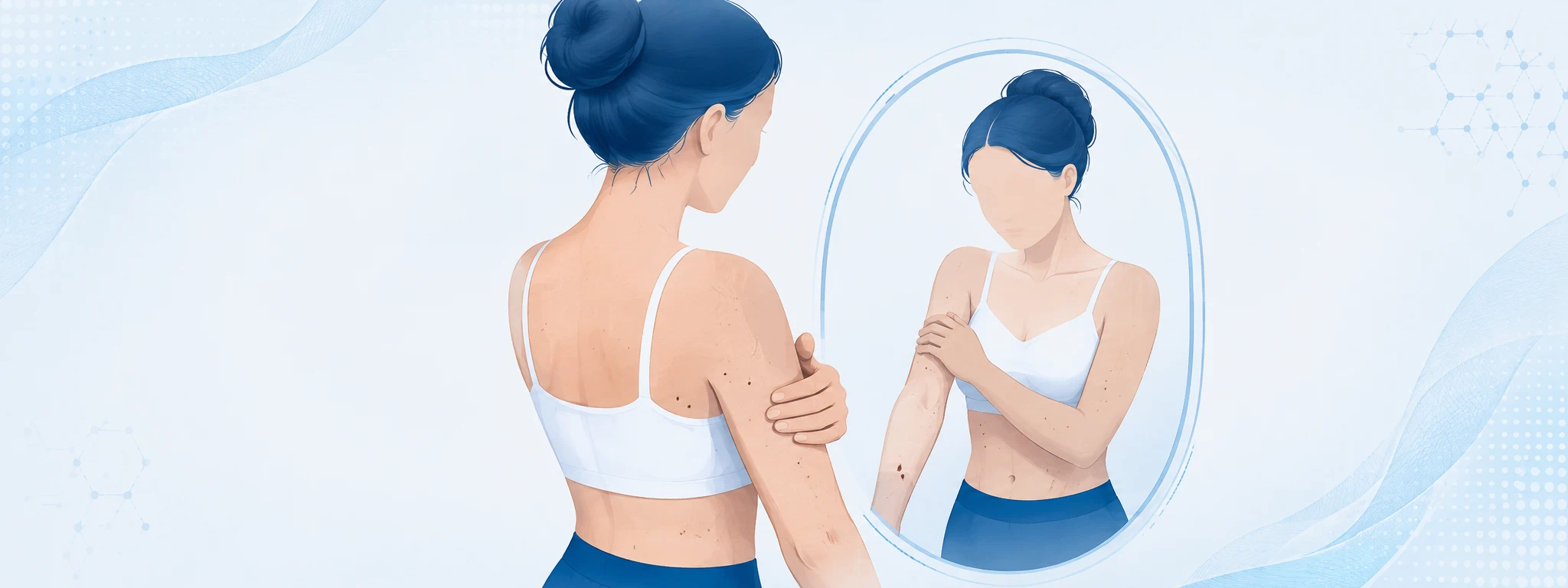 Autoexamen de la piel frente al espejo revisando lunares y manchas